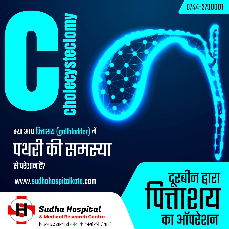 cholecystectomy surgery in Kota | Sudha Hospital & Medical Research Centre