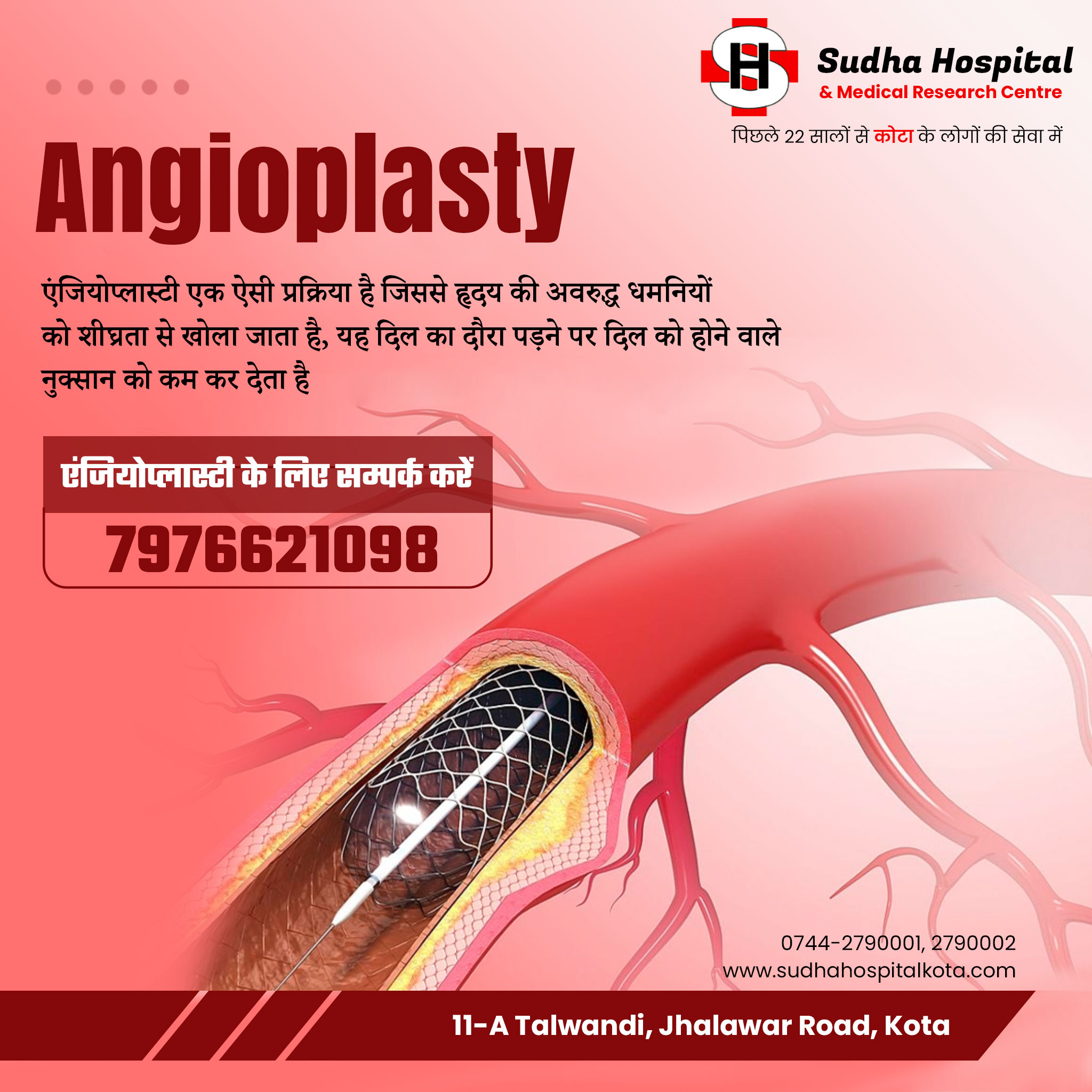 Angioplasty In Kota | Sudha Hospital & Medical Research Centre