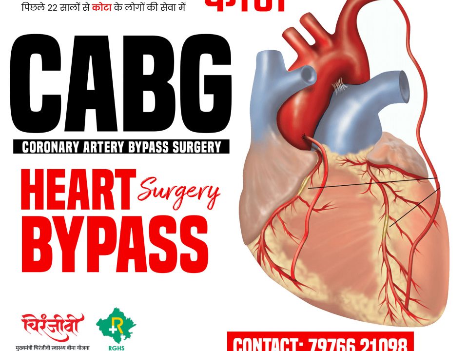 Heart Bypass Surgery in Kota | Sudha Hospital & Medical research Centre