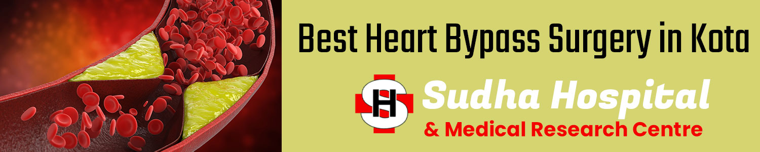 Heart Bypass Surgery in Kota | Sudha Hospital &  Medical Research Centre