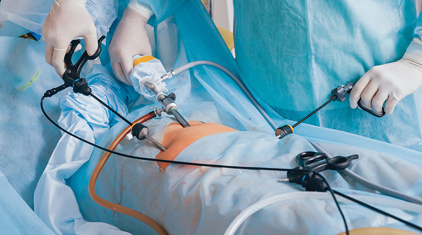laparoscopy-surgeru-in-kota